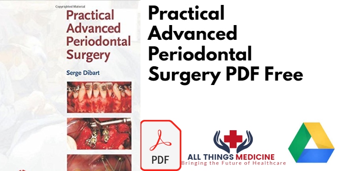 Practical Advanced Periodontal Surgery PDF Free
