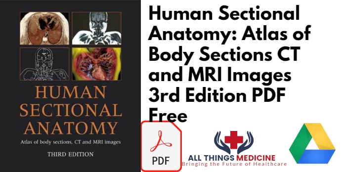 Human Sectional Anatomy: Atlas of Body Sections CT and MRI Images 3rd Edition PDF Fre