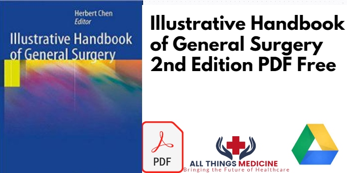 Illustrative Handbook of General Surgery 2nd Edition PDF Free