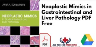 Neoplastic Mimics in Gastrointestinal and Liver Pathology PDF Free