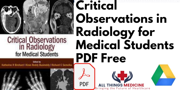 Critical Observations in Radiology for Medical Students PDF Free