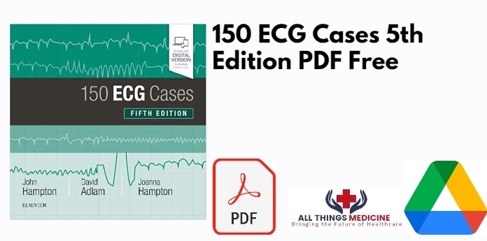 150 ECG Cases 5th Edition PDF