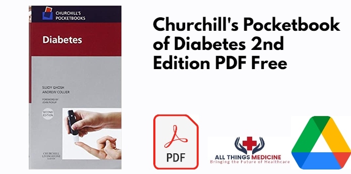 Churchill's Pocketbook of Diabetes 2nd Edition PDF