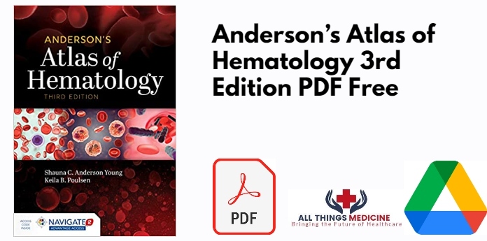 Anderson’s Atlas of Hematology 3rd Edition PDF